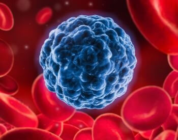 A picture of a cancer cell in the bloodstream