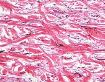A picture of human skin cells under a microscope