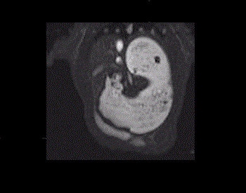 An MRI image of the human stomach