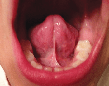 A picture showing the bottom of the human tongue