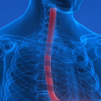 A Picture of the Esophagus