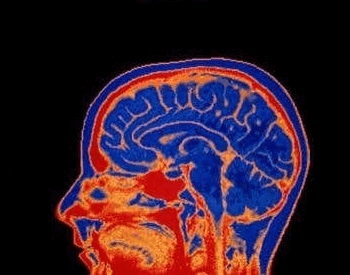 An MRI (Magnetic Resonance Image) of the human brain