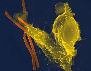 A picture of a white blood cell (yellow) attacking anthrax bacteria (orange)