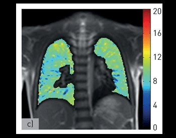 An MRI image of the human respiratory system