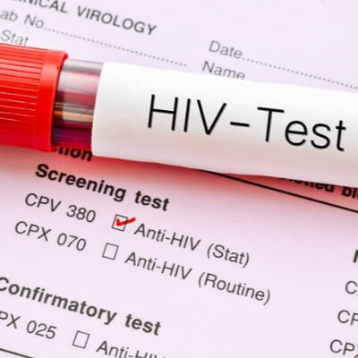 A Picture of HIV