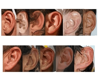 A picture of many different types of human earlobes
