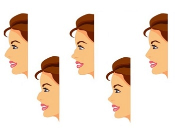 A diagram of the different shapes of the nose