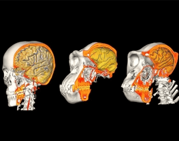 A image comparing the brain size of humans to primates