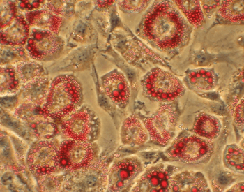 A picture of human fat cells under a microscope