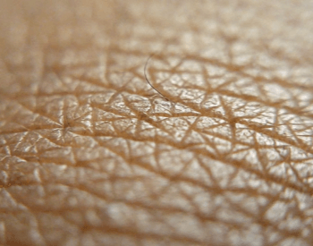 A close-up picture of human skin and a human hair