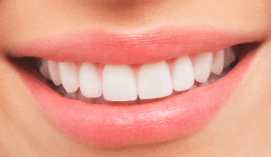 A close-up picture of the front teeth of a human