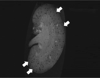 An MRI image of a human kidney
