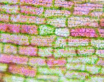 A picture of a plant cell under a microscope