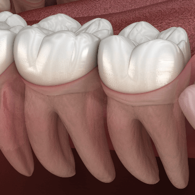 A Picture of Human Teeth