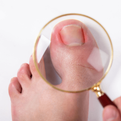 A Picture of Human Toenails