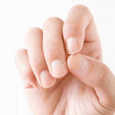 A Picture of Human Fingernails